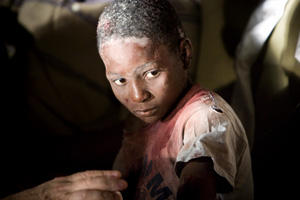 An injured child is tended to at the Hotel Villa Creole in Port-au-Prince, Haiti, Tuesday, Jan. 12, 2010. (AP Photo/The Canadian Press, Ivanoh Demers, Montreal La Presse) 